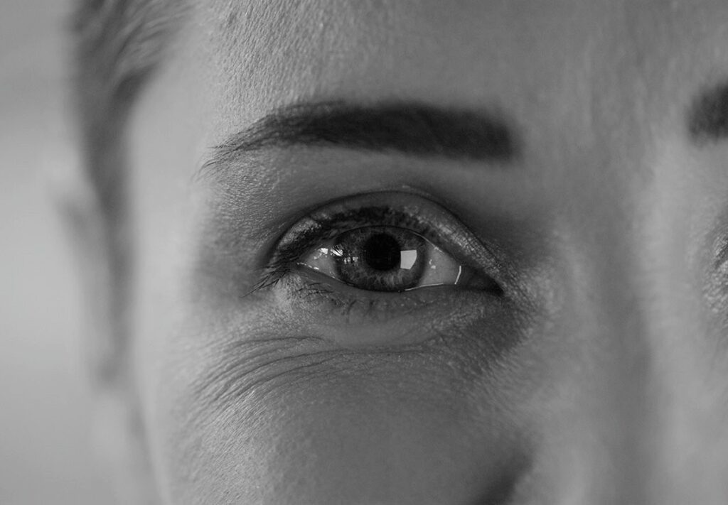Anti Wrinkle Treatment london
