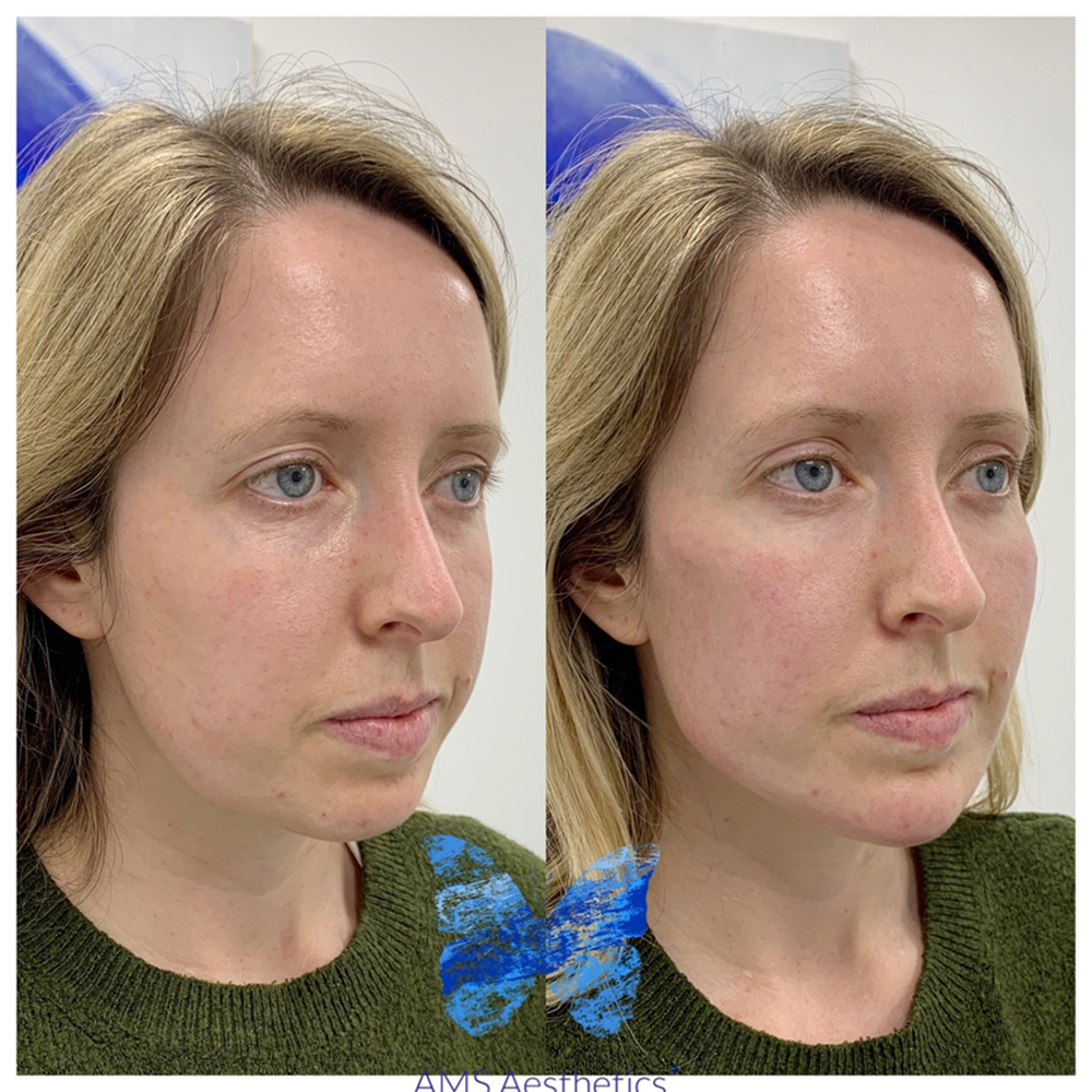 Copy of Facetune_23-05-2021-20-33-37 (1)