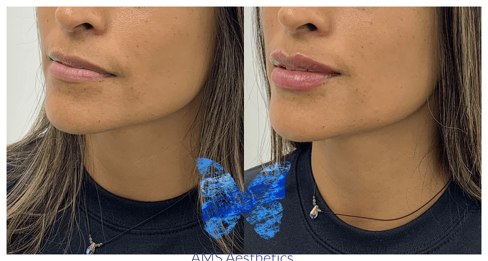 Heart Shaped Lips (Cupi Bow)