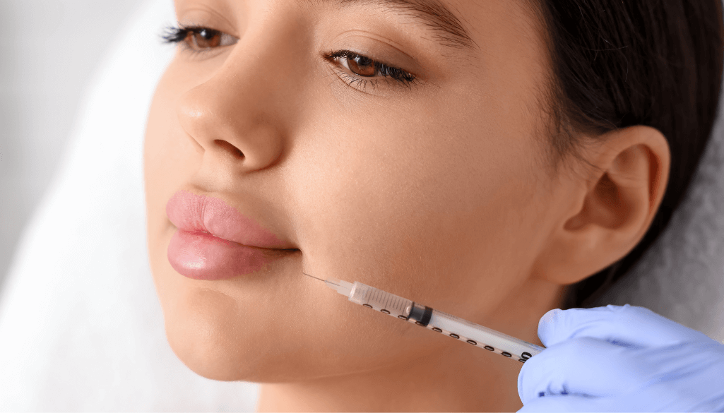 lip filler swelling stages