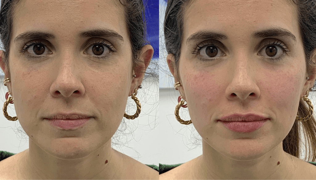 Best Facial Aesthetic Treatments