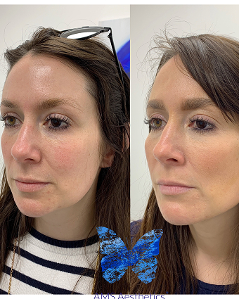 Copy of 73EC5D28-0830-4AE5-AD8F-8F27BFABC248 1