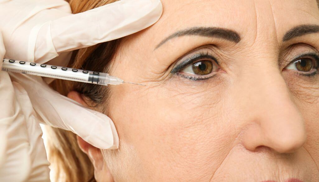 Women Have Wrinkles & Fine Lines on face