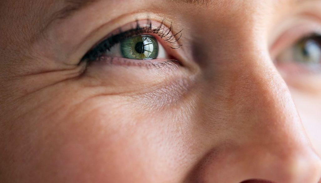 Women having Crow's Feet Eyes