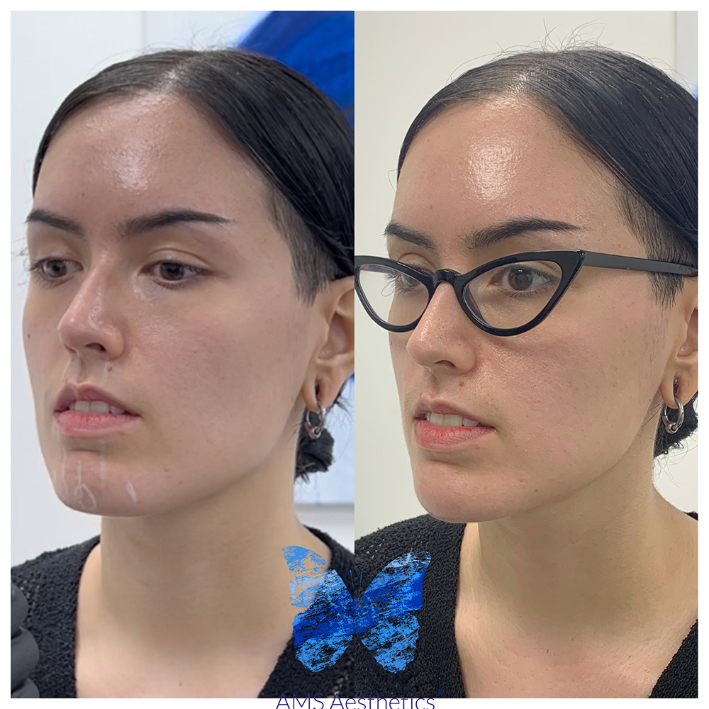 877D8C50-0EFC-4E31-8F26-3F05132EA36E