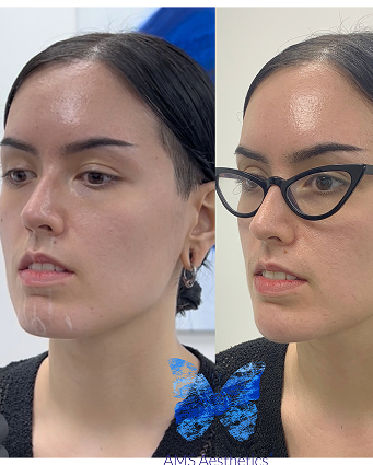 877D8C50-0EFC-4E31-8F26-3F05132EA36E