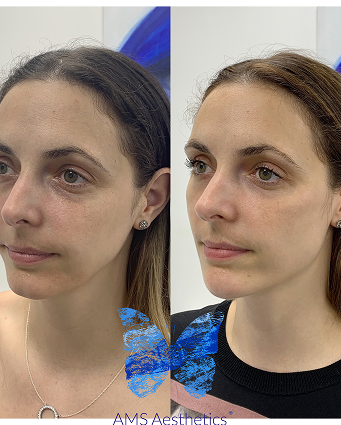 C9E2BBE6-C17E-4024-A4A7-2C9BD20A073A (1)