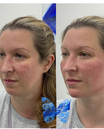 D1D1FDC9-9210-453F-866D-2A19226003C4 (2) (1)