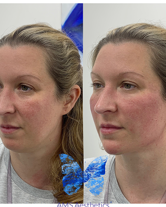 D1D1FDC9-9210-453F-866D-2A19226003C4 (2)