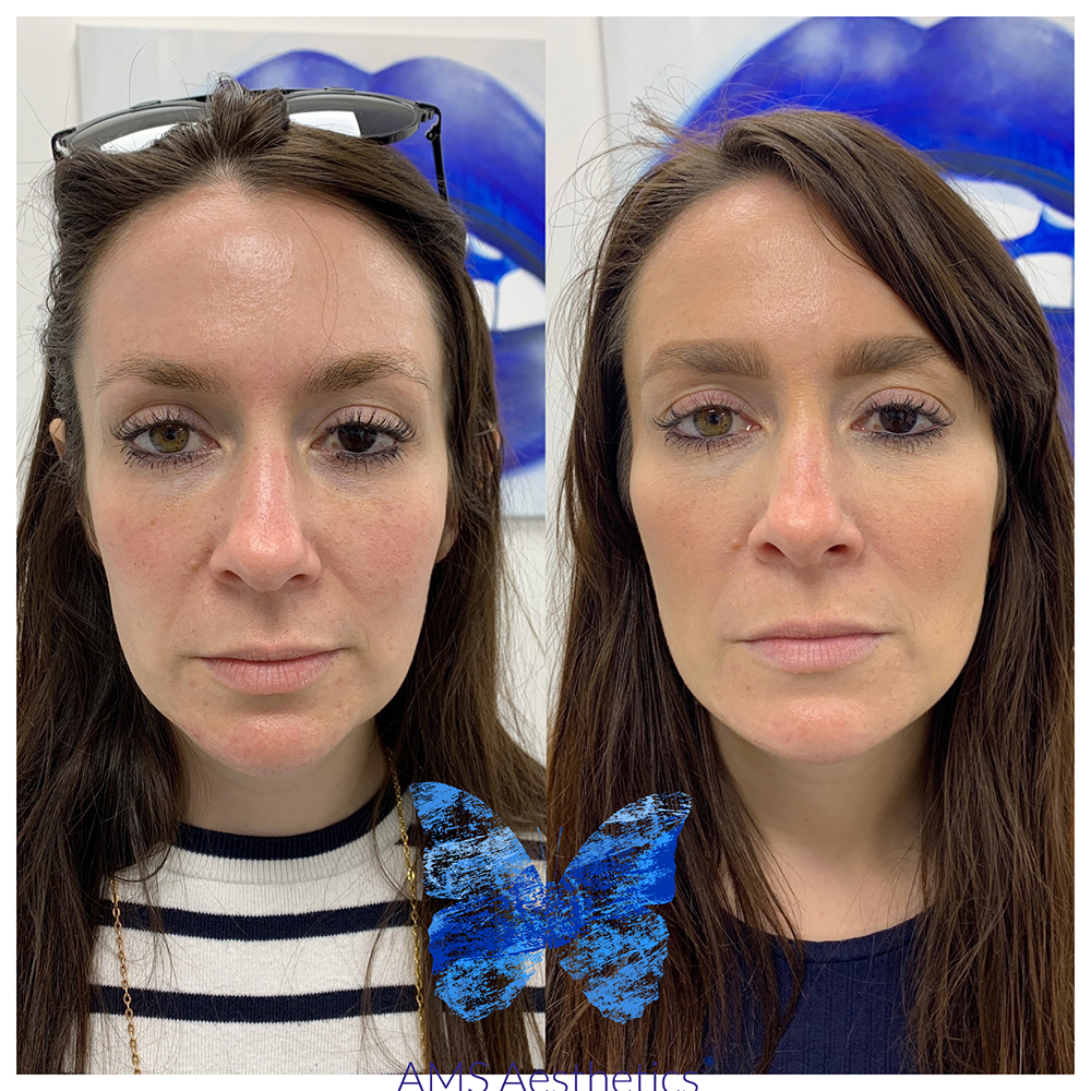 ED75E80D-0C1C-4D33-8778-276B6E5E9242