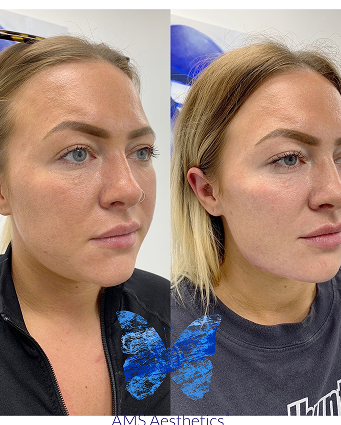 Facetune_08-08-2021-20-18-24 (2)