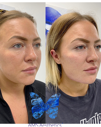 Facetune_08-08-2021-20-18-24 (3) (1)