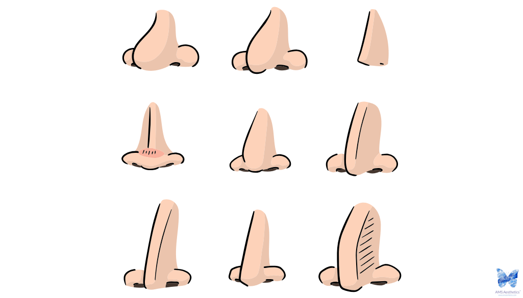 Types of noses