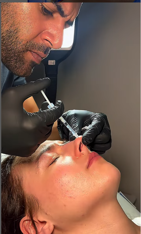How Long Does a Nose Filler Session Take